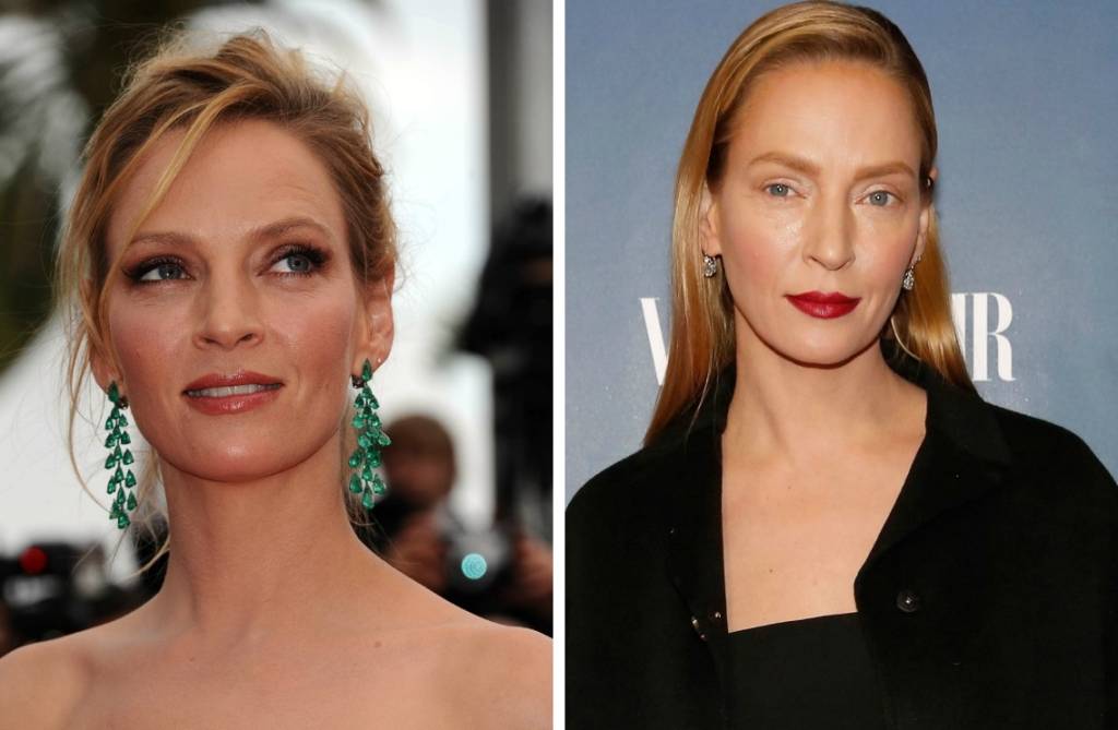 Uma Thurman: entenda os procedimentos que podem ter transformado a aparência da atriz