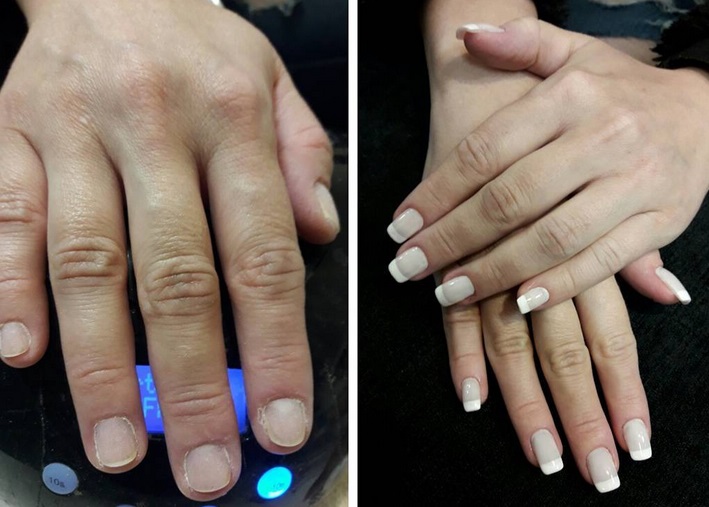 Unhas de gel: tudo sobre a técnica que dura até 4 meses