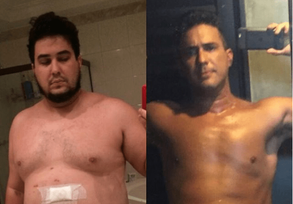 ‘Medo de morrer’: o emocionante relato de André Marques sobre a bariátrica