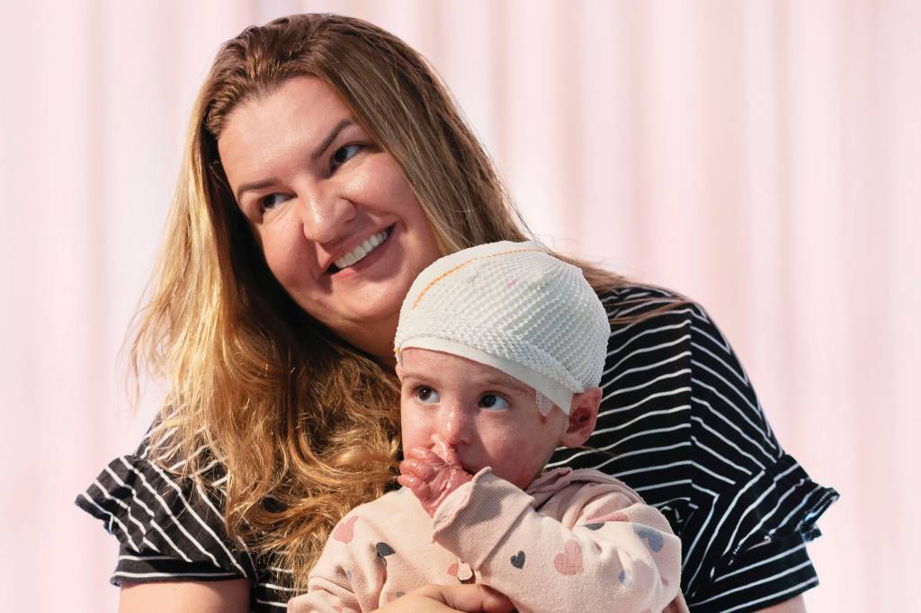 A emocionante história de Maju, a bebê com epidermólise bolhosa