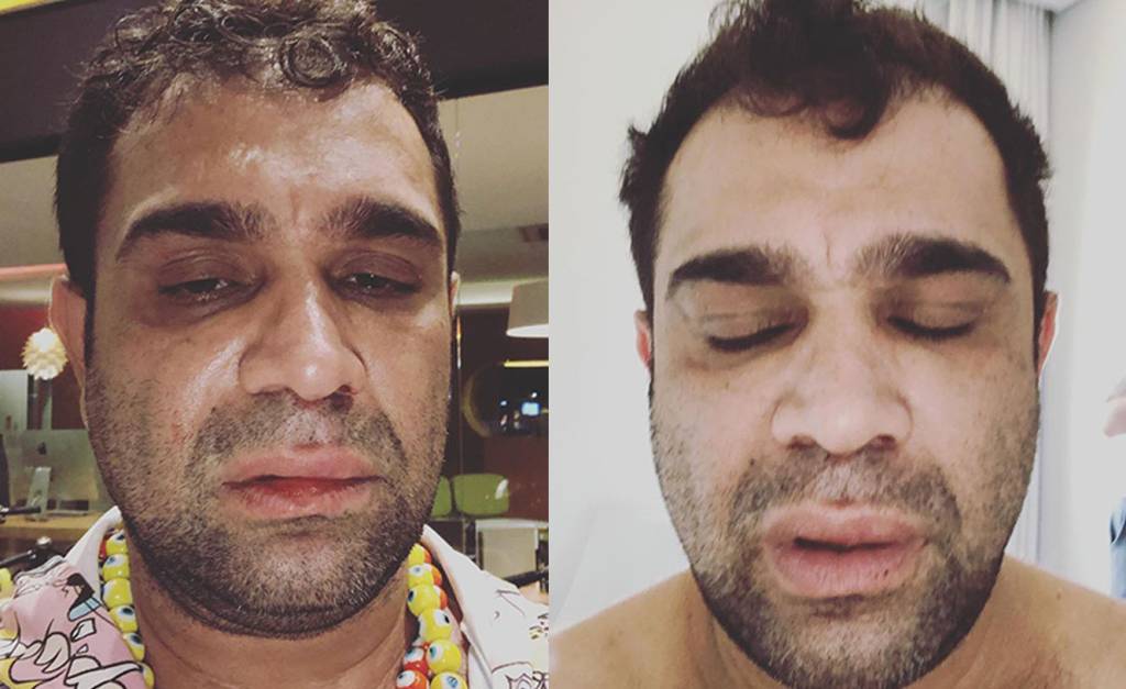 Humorista Evandro Santo pede indenização por agressão