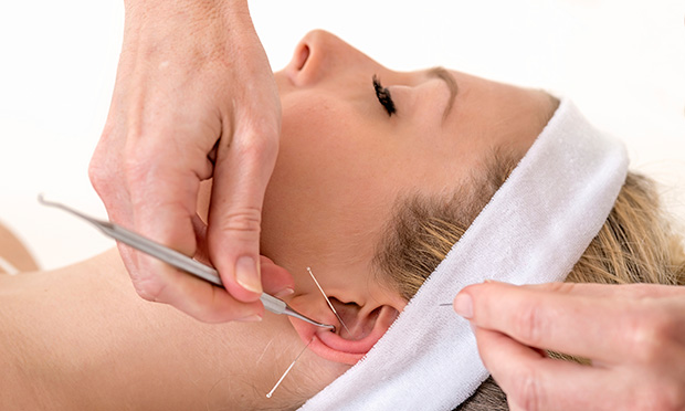 Acupuntura emagrece: técnica chinesa reduz inchaço e ajuda a diminuir gordura