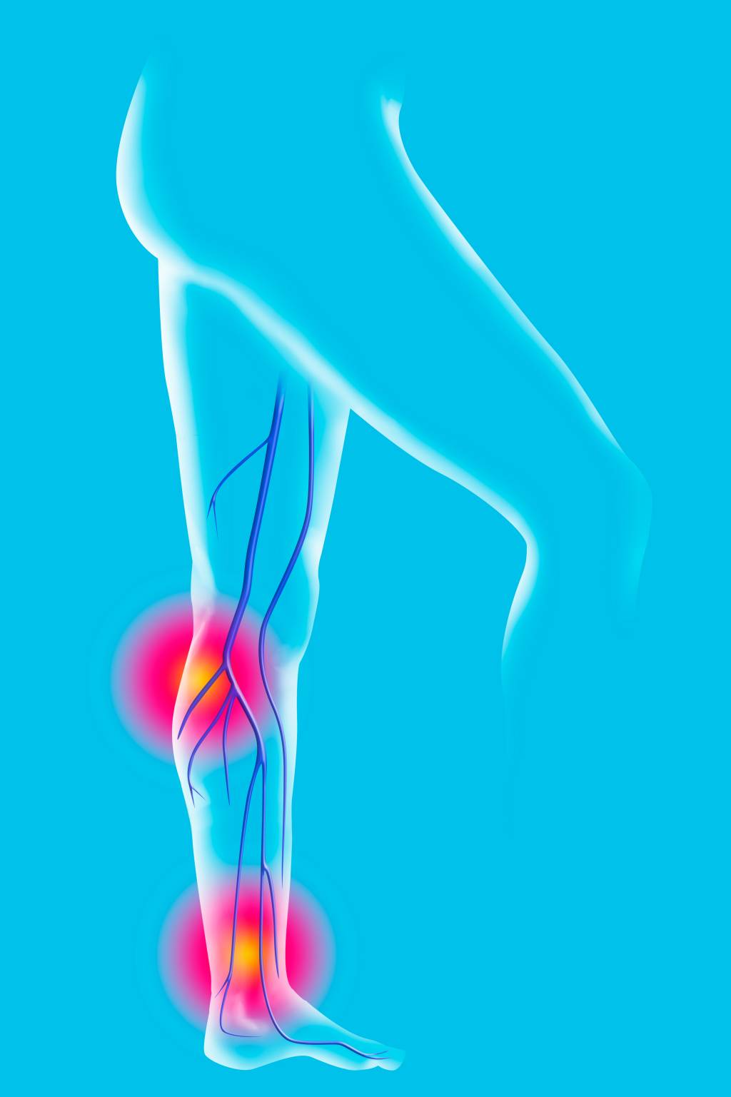Da causa ao tratamento, 10 dúvidas respondidas sobre varizes