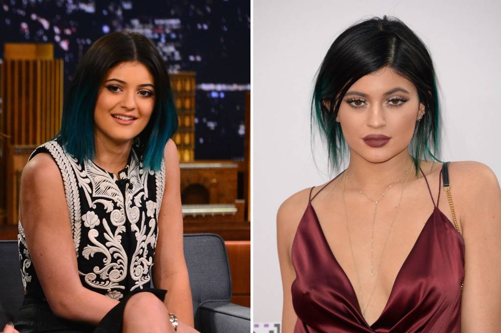 kylie jenner labios kylie jenner labios