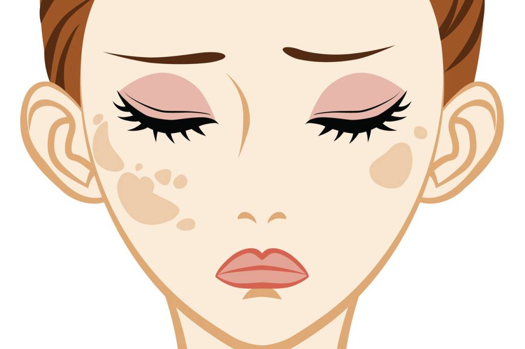 10 dúvidas sobre manchas na pele respondidas por médicos