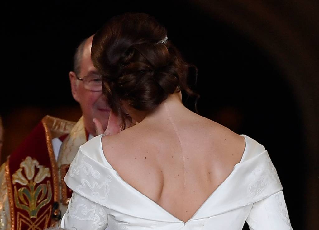 Princesa Eugenie, no dia de seu casamento, com cicatriz de cirurgia de escoliose à mostra