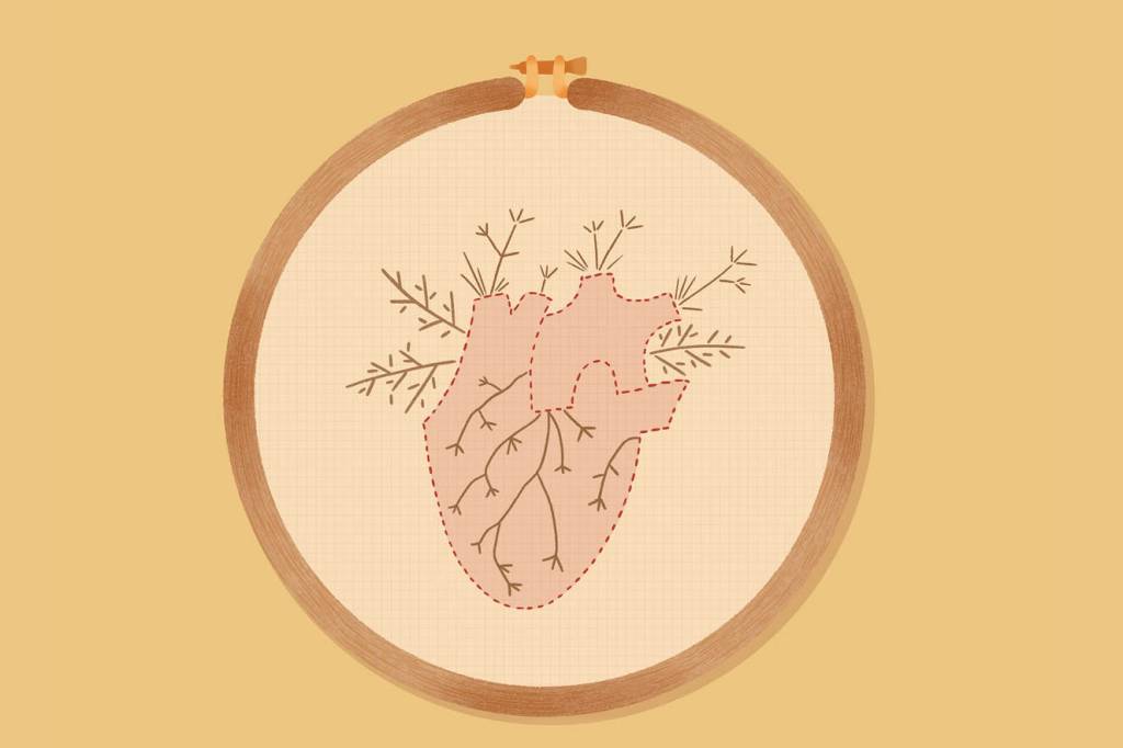 Síndrome com sintomas parecidos aos do infarto cresce entre as mulheres