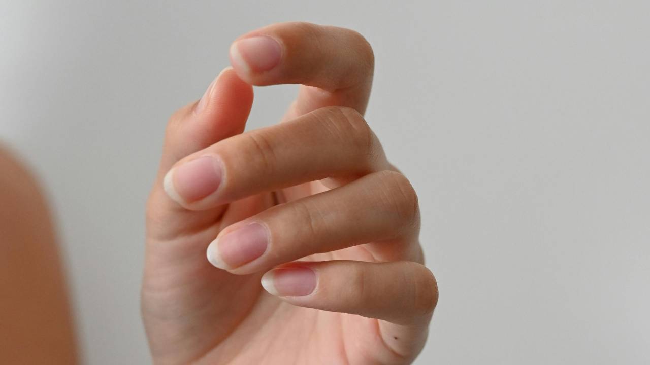 unhas amareladas