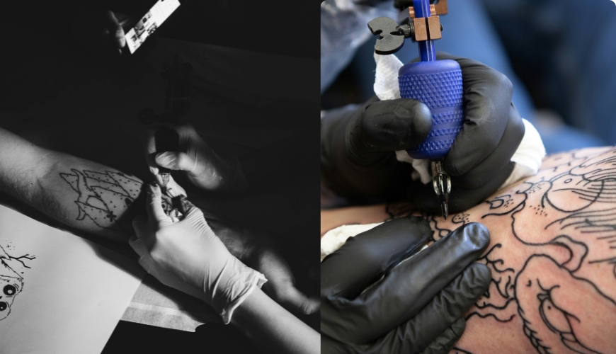 Quanto custa e como funciona a remoção de tatuagem?