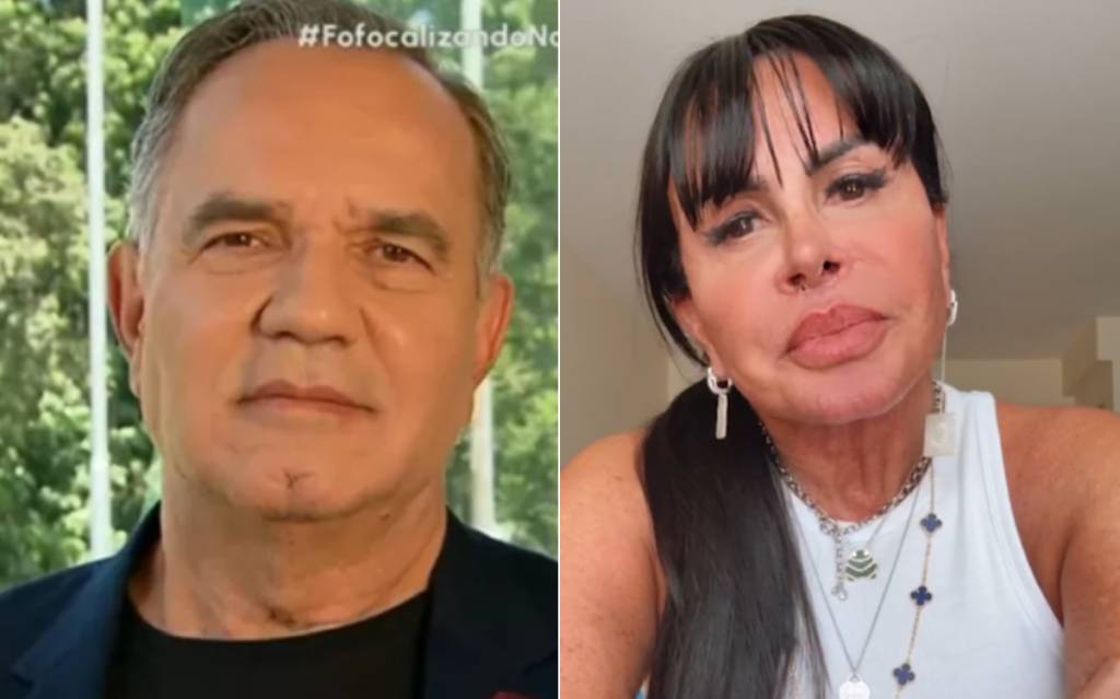 4 famosos que se renderam à harmonização facial: veja o antes e depois!