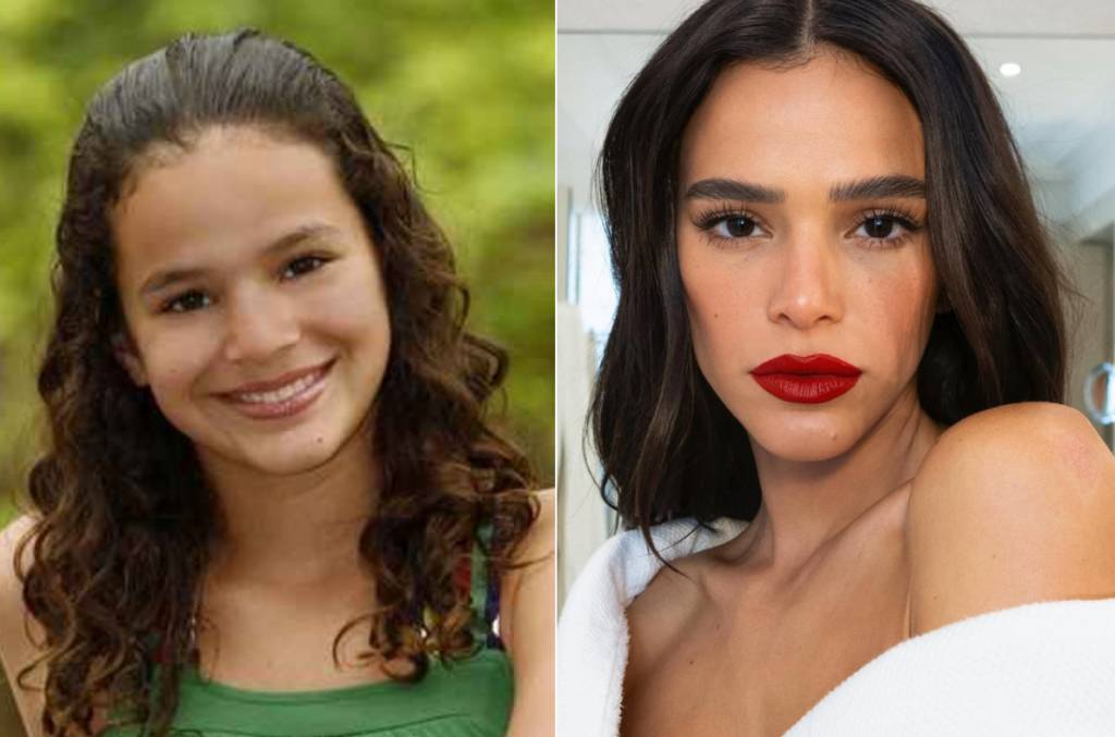 rinoplastia-antes-depois-bruna-marquezine (2) Bruna Marquezine na adolescência e hoje em dia