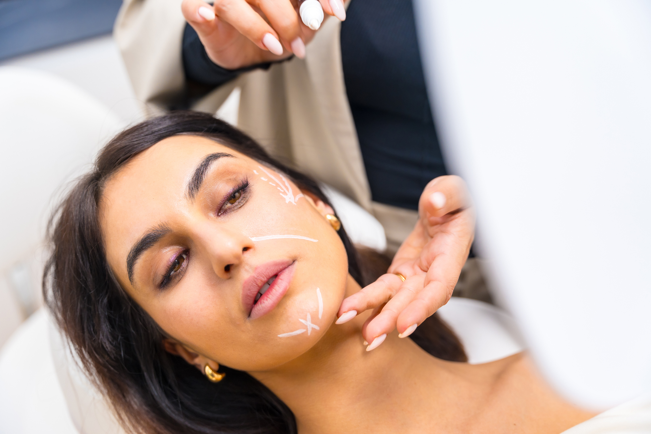 O lifting que não precisa de bisturi